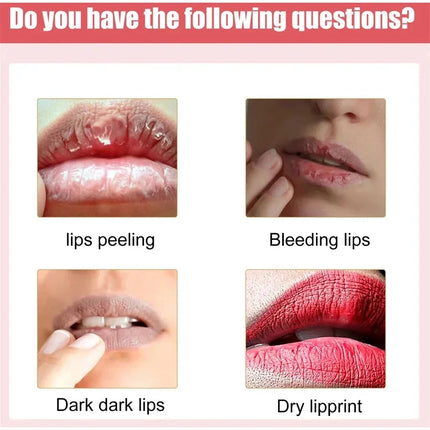 15g Remove Dark Lip Balm Lip Essence Cream Lighten Lip Lines Whitening Moisturizing Brightening Serum Lip Care Product Women Men