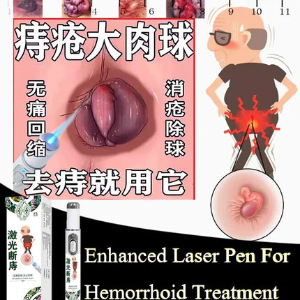 Enhanced Hemorrhoids Treatment Eliminates Internal External Hemorrhoids Lumps Fast Relief