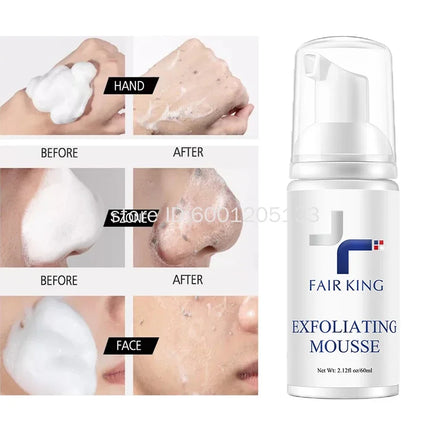 Exfoliating Mousse Improves Skin Texture Gentle Cleansing Makeup Dust Improves Enlarged Pores Oil-control Rosemary Cosmetics