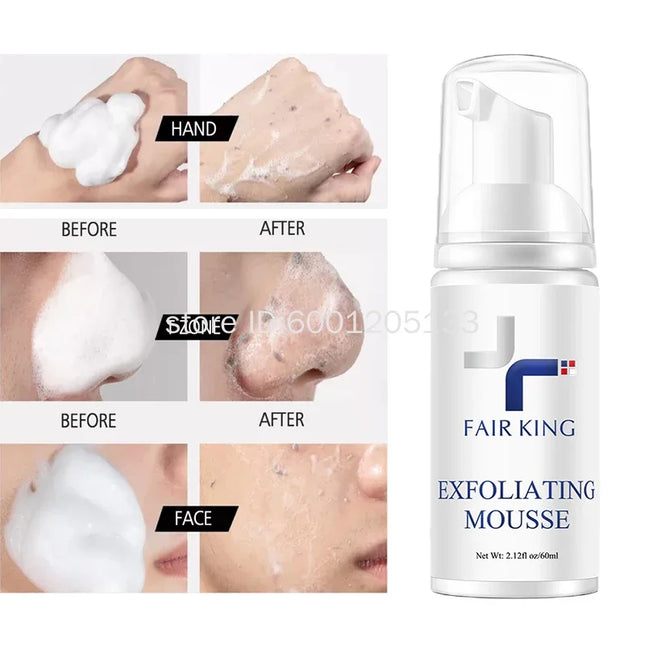 Exfoliating Mousse Improves Skin Texture Gentle Cleansing Makeup Dust Improves Enlarged Pores Oil-control Rosemary Cosmetics