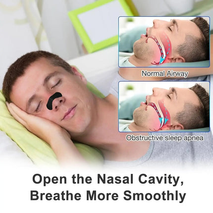 Nasal Breathing Dilators Starter Kits, Anti-snoring Nasal Strips, Magnetic Nose Strips, Increase Sports Air, Improve Sleeping