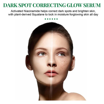 Dark Spot Correcting Glow Serum,Dullness,Acne,And Melanin Remover,Niacinamide Facial Skin Moisturizing Brightening Skincare