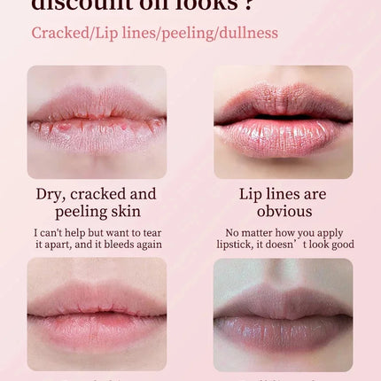 Remove Dark Lip Balm Moisturizing Lighten Melanin Bleaching Lip Gloss Lip Pink Lipstick Exfoliating Fade Lip Line Beauty Health