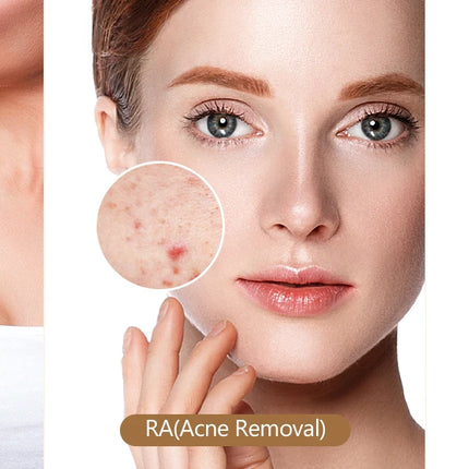 IPL Devices Hair Removal Laser 17J 999900 Light Pulses HR/SC/RA 9 Levels Whole Body Painless Hair Removal Home Use For Men Women
