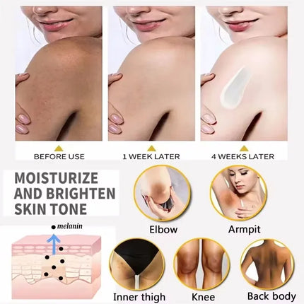 Nicotinamide Brightening Cream For Dark Skin Effective Lighten Thigh Inner Bleach Remove Melanin Private Parts Brighten Cream