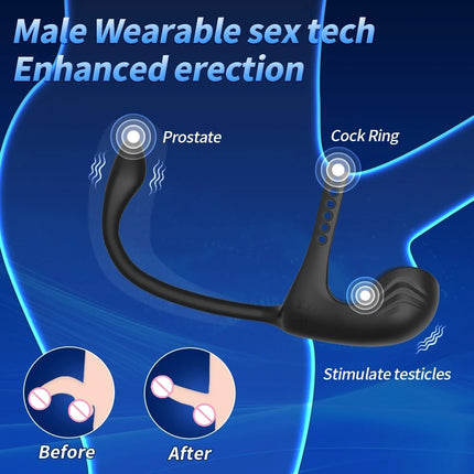 3 in 1 Anal Plug Vibrator Testicle Taint Stimulator Vibrating Cock Ring Remote Control Male Prostate Massager Sex Toy for Couple
