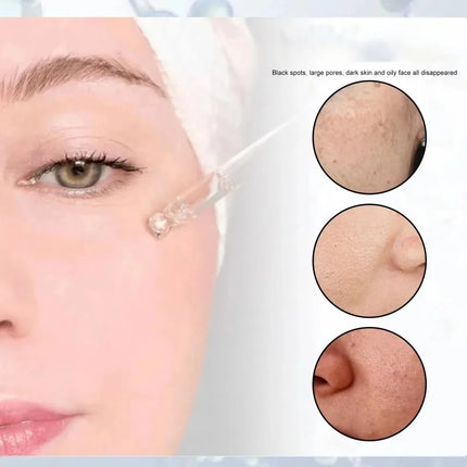 Smooth skin|Shrink pores, facial serum with retinol and niacinamide