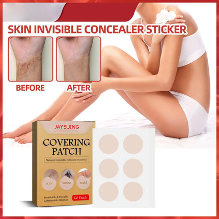 Skin concealing patch-waterproof cover for scars, tattoos, acne marks, birthmarks-natural looking, breathable, reusable