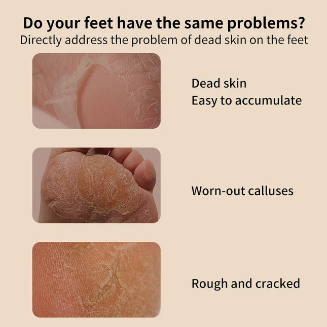 Electric foot grinder for quick removal of dead skin and calluses, suitable for two types of grinding heads and two speeds