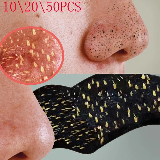 10-40pcs Blackhead Remover Nose Sticker Acne Treatment Mask Nose Sticker 5-60pc From Black Dots Cleaner Nose Pore Cleaning Skin