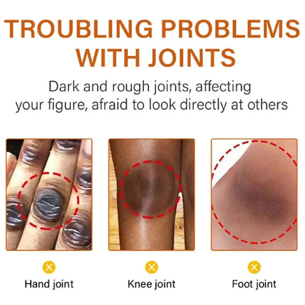 Body Whitening Cream Arms Thighs Underarm Knees Whitening Essence Cream Brighten Moisturizing Body Korean Skin Care Products