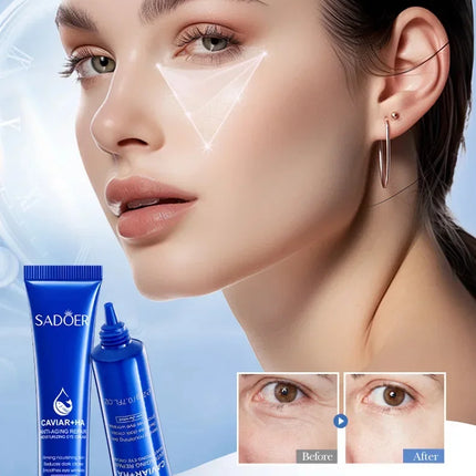 Caviar Eye Bag Removal Cream Hyaluronic Acid Anti-Wrinkle Firming Skin Fade Fine Lines Anti Dark Circle Puffiness Eye Care 20g