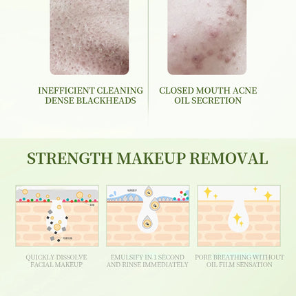 Makeup Removal for Face Purifying Pores Shrinking Refreshing Non Irritating Cleansing Oil Remove Blackhead Soothing Skin