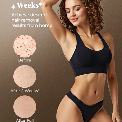 Haarlosy IPL Devices Hair Removal Laser Painless Hair Removal Device with HR/SC/RA, 9 Levels, 999,900 Flashes at Home for Women