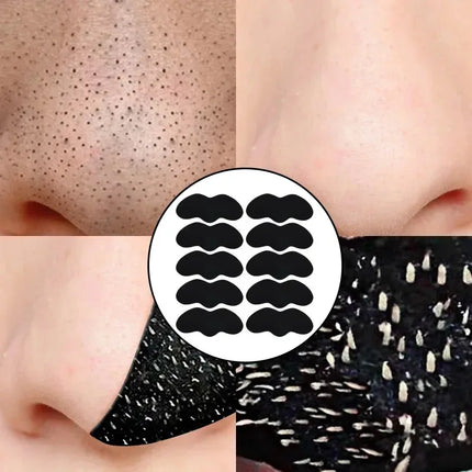 10/20/30Pcs Deep Cleansing Pore Nose Black Head Removal Stickers Peel Off Blackhead Remove Mask Nasal Strips Unisex Skin Care