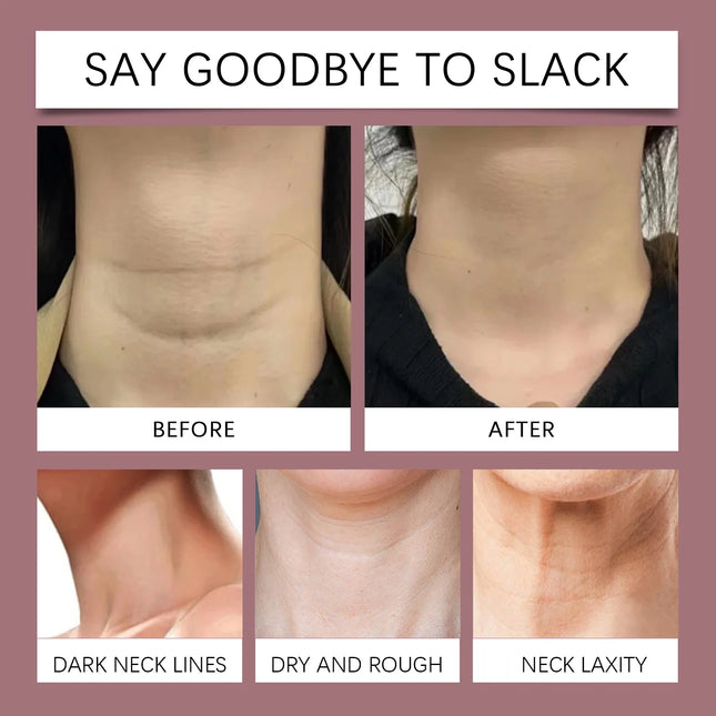 HOYGI Collagen Neck Cream Firming Lasting Hydration Increase Skin Elasticity Fade Fine Lines Nourishing Smooth Neck Care Lotion