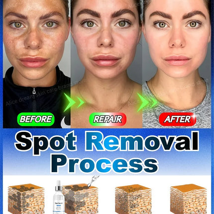 2025 Bestselling Facial Spot-Fading Cream, Effectively Removes Facial Dark Spots