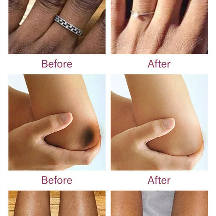 Body Whitening Cream Arms Thighs Underarm Knees Whitening Essence Cream Brighten Moisturizing Body Korean Skin Care Products