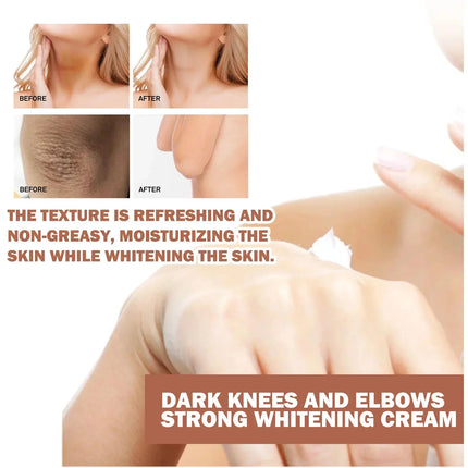 Dark Knuckles Fast Brighten Cream Elbows Hand Knuckle Brightening Serum Knee Black Skin Quickly Lighten Stains Remover Products