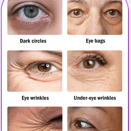 Eye massage instrument, relieve eye fatigue, eliminate eye bags, reduce dark circles, brighten eyes