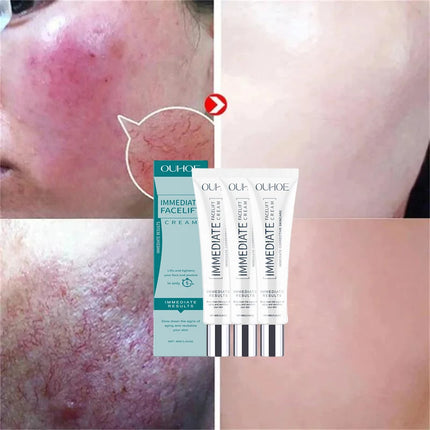 Facial Redness Repair Cream Improve Sensitive Skin Dryness Moisturizer Hydrating Sooth Lotion Removal Rosacea Korean Cosmetics