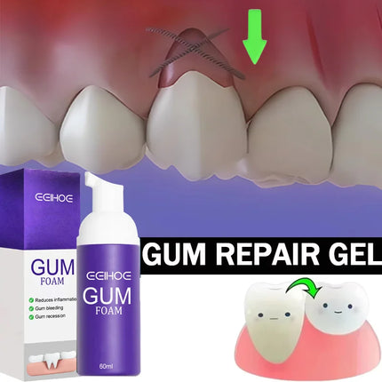 Rapid Repair Gums Gel Effectively Relieve Tooth Allergy Dental Caries Tooth Cleaning Toothpaste Relieve Tooth Damage Serum 665*