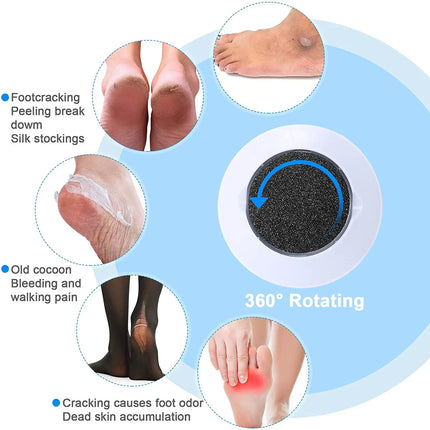 6PCS Replaceable Roller Foot File Pedicure Hard Dead Skin Callus Remover Refills Replacement Rollers Foot Files Accessories