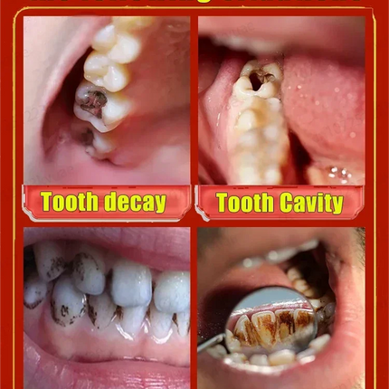 Cavity killer
