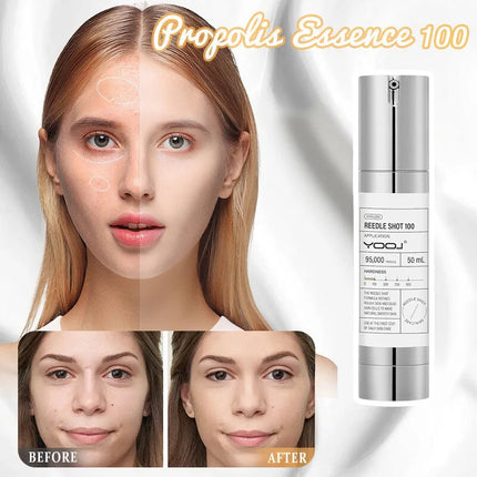 Korean Microneedle Essence Desalination Fine Lines Spots Collagen Solution Reverse Aging Recombinant Improves Rough Texture 50ml