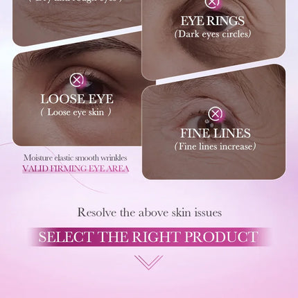 Instant Eye Bag Remove Eye Cream Anti Fat Particles Dark Circles Puffiness Fade Fine Lines Lift Brighten Korean Beauty Eye Care