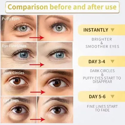 Eye cream nourishes eye area skin, tightens, smooths fine lines, deeply moisturizes, glows with radiance