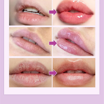 Remove Dark Lip Balm Fast Lightening Pink Lip Exfoliating Fade Lip Line Dead Skin Moisturizer Korean Care Products Beauty Health