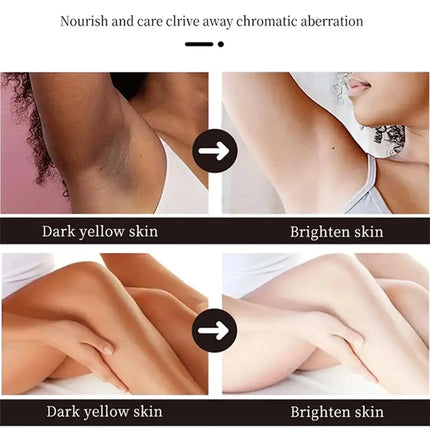 Nicotinamide Brightening Cream For Dark Skin Effective Lighten Thigh Inner Bleach Remove Melanin Private Parts Brighten Cream