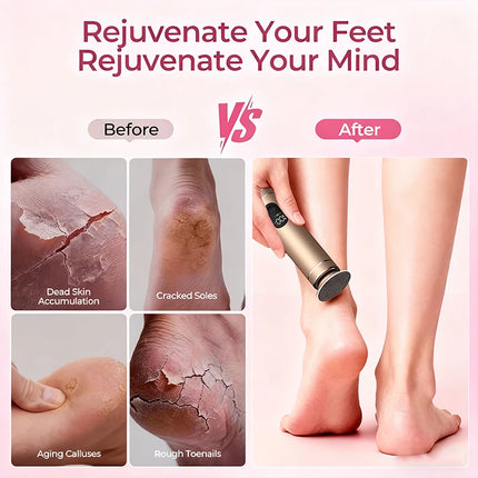 aluminum alloy 2-in-1 Foot and Hand Electric Care Tools, Electric Callus Remover, Electric Food Grinder with Gifts box