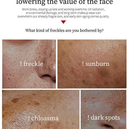 Powerful Spot-removing Whiten Cream Brighten Skin Fast Eliminates Melanin Pigmentation Melasma Dark Spots Moisturize Beauty Gel