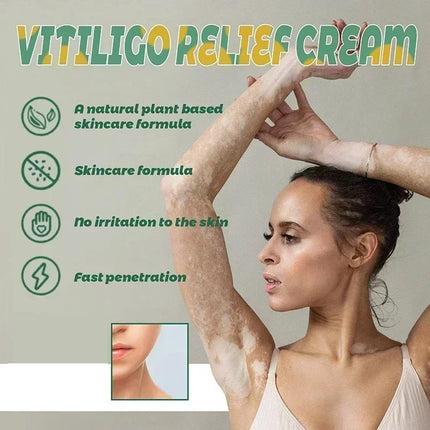 [New] Vitiligo Cream Vitiligo Remover Tinea Versicolor Body Lotion Helps Get Rid of Sweat Spot Vitiligo, Skin Vitiligo Clear