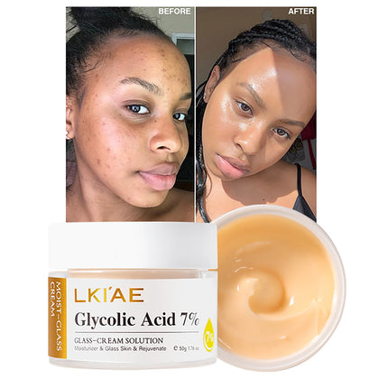 LKIAE Brightening Face Cream, Moisturizing, Reduce Black Spots, Hyperpigmentation, Wrinkles, Fine Lines, With Hyaluronic Acid