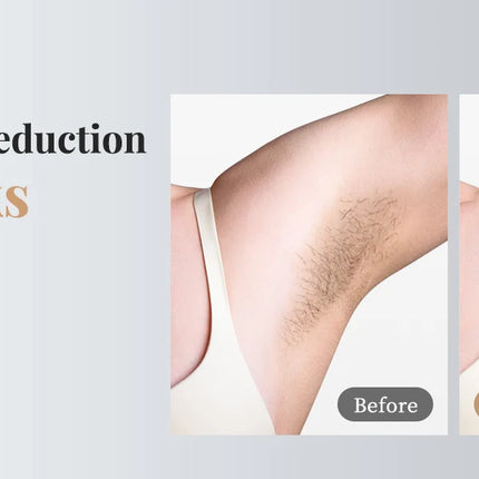 Laser Hair Removal Pro IPL Devices Painless Permanent Epilator with HR/SC/RA, 9 Energy Levels 999999+ Light Body Hair Trimmer