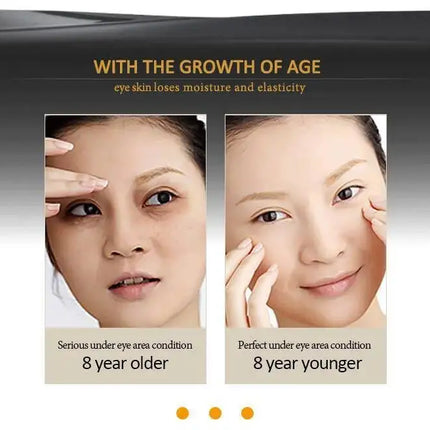 Eye Serum Roller Massager & Gold Eye Cream Eye Care 2pcs/set Dark Circles Fade Puffiness Moisturizing