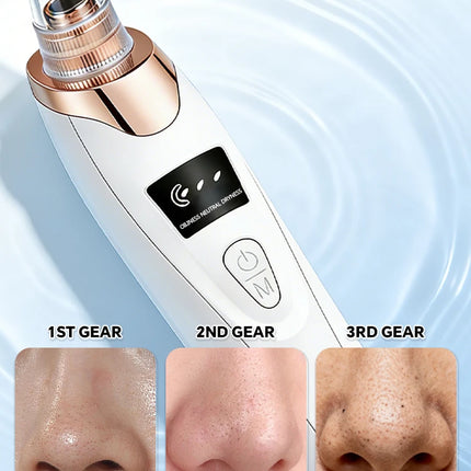 Blackhead Remover pimples and blackheads vacuum pores removal  facial skin cleansing device For Deep cleaning home